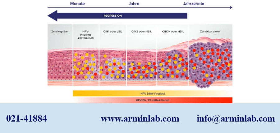 HPV Aptima mRNA Assay Test