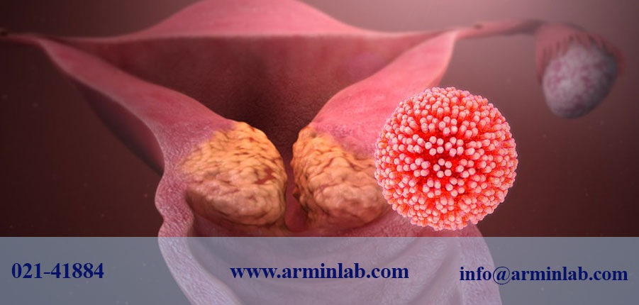 سرطان دهانه رحم و HPV