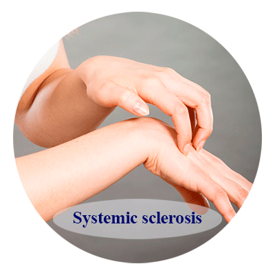 Systemic sclerosis