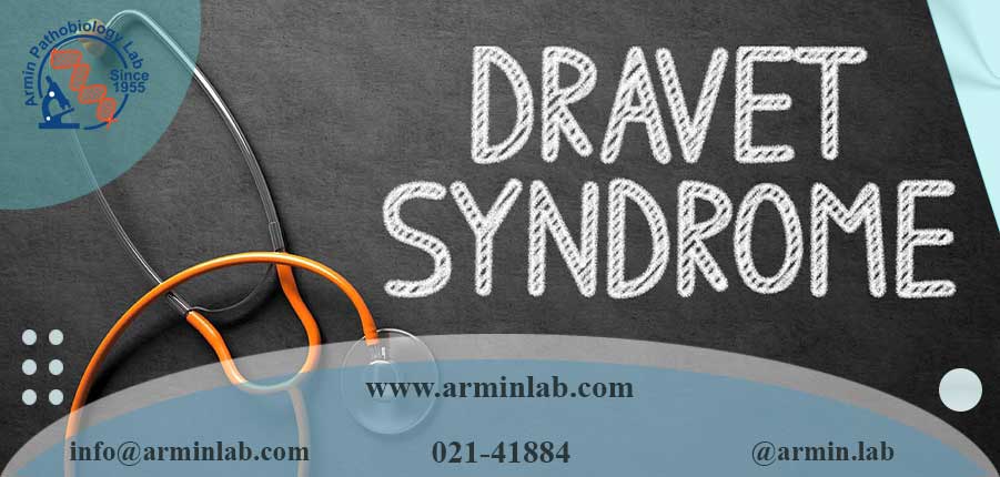 سندرم دراوه (Dravet Syndrome)