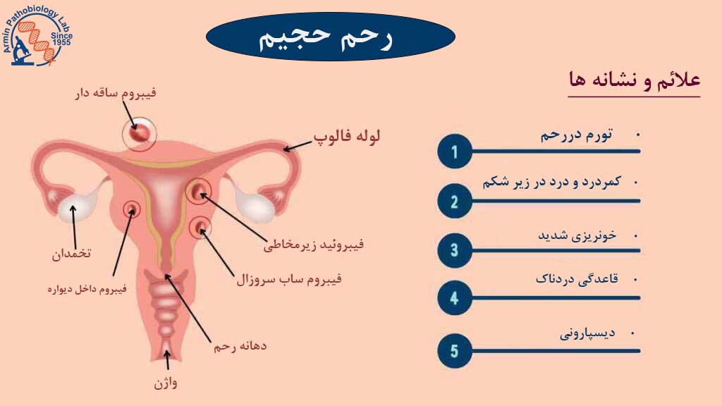 رحم حجیم