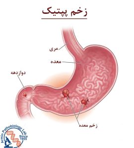 زخم اثنی عشر