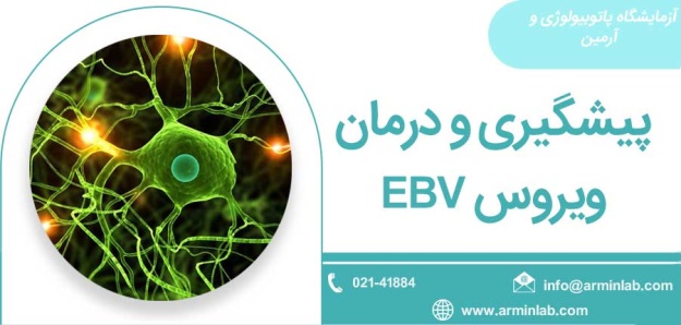 پیشگیری و درمان ویروس EBV