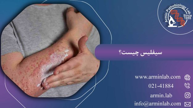 سیفلیس چیست؟