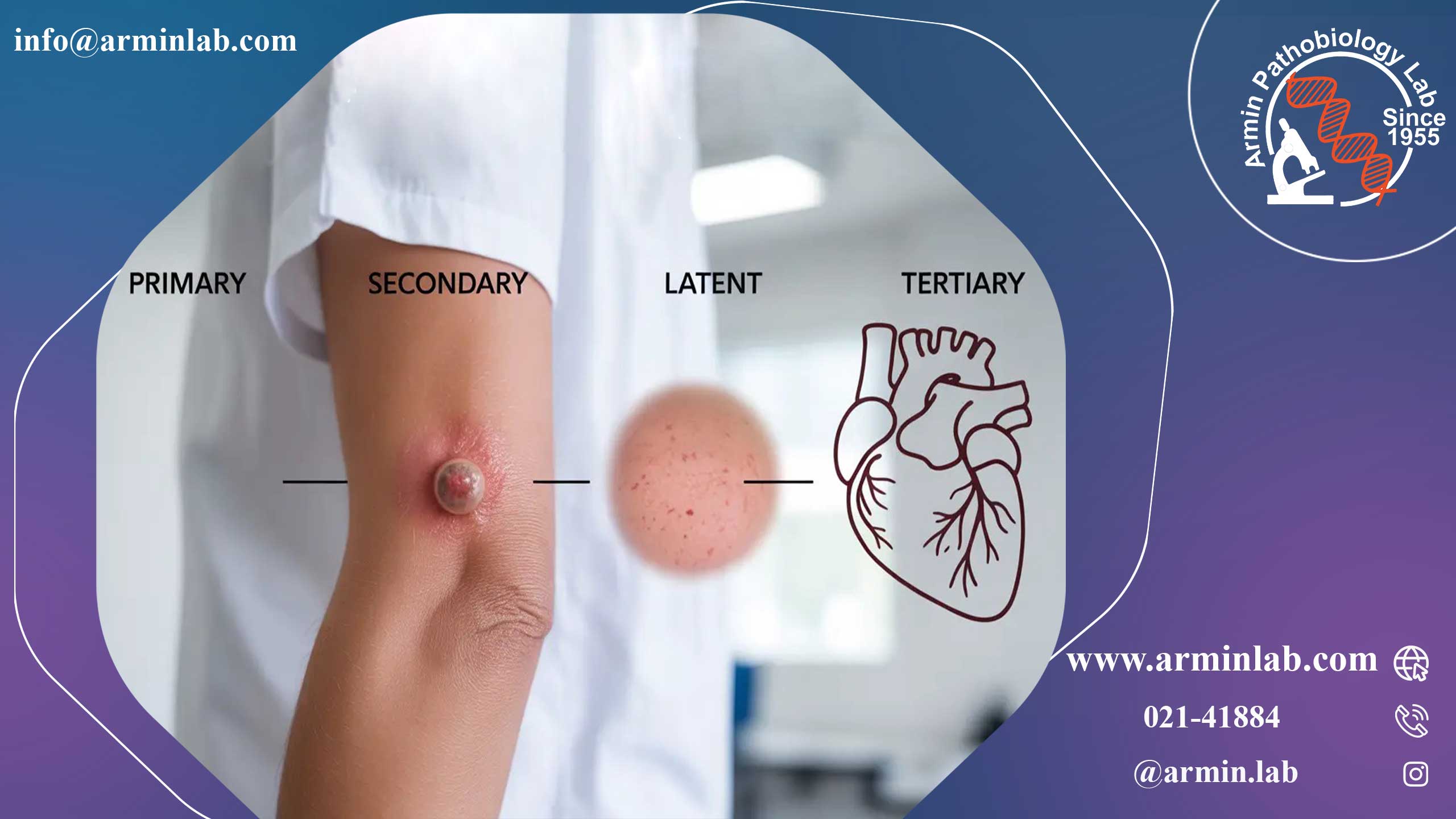 سیفلیس چیست؟