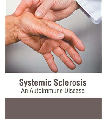 آزمایش بیماری های خود ایمنی اسکلوریزیس سیستمیک اسکلوریزیس systemic sclorisis