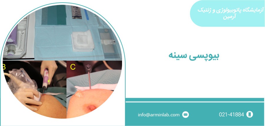 بیوپسی سینه