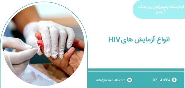 آزمایش HIV تست HIV آزمایش HIV
