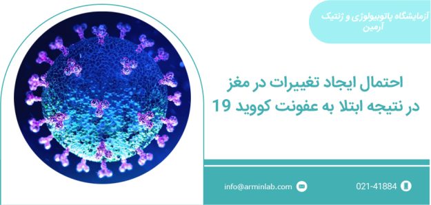 تغییرات در مغز با کووید19