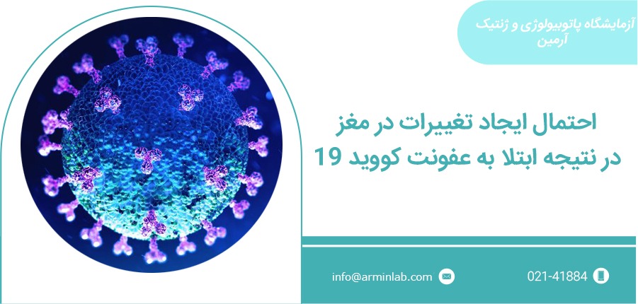 تغییرات در مغز با کووید19