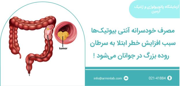 مصرف خودسرانه آنتی بیوتیک