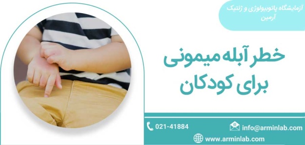 monkeypox1 خطر آبله میمونی برای کودکان