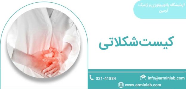 کیست-شکلاتی-arminlab کیست شکلاتی