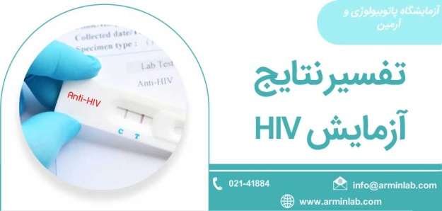 تفسیر نتایج آزمایش HIV