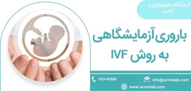 باروری آزمایشگاهی به روش IVF
