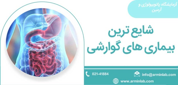 شایع ترین بیماری های گوارشی