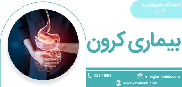 بیماری کرون