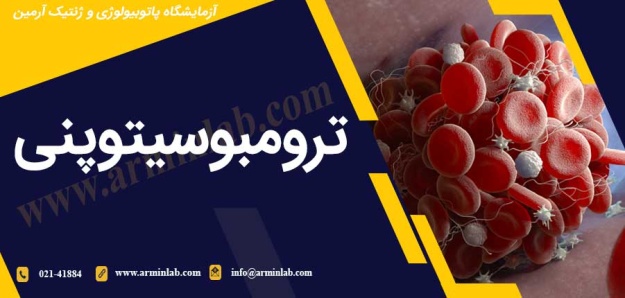 ترومبوسیتوپنی