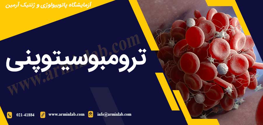 ترومبوسیتوپنی