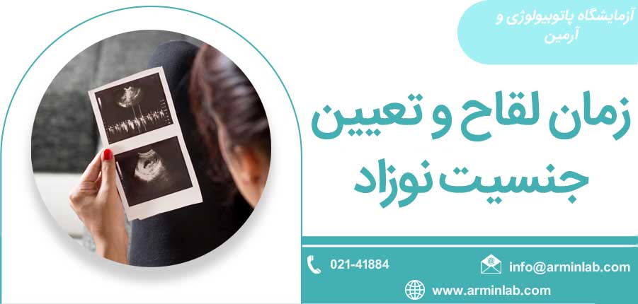 زمان لقاح و تعیین جنسیت نوزاد