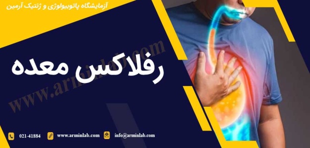 رفلاکس معده