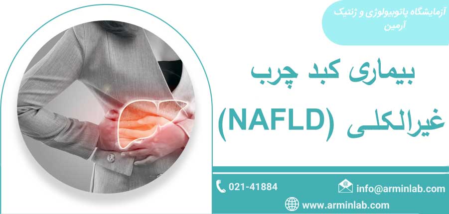 بیماری کبد چرب غیرالکلی (NAFLD)