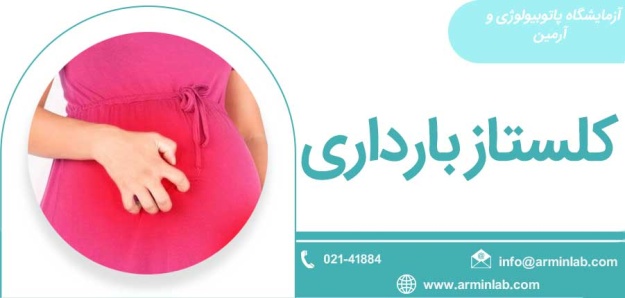 کلستاز بارداری