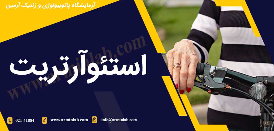 استئوآرتریت