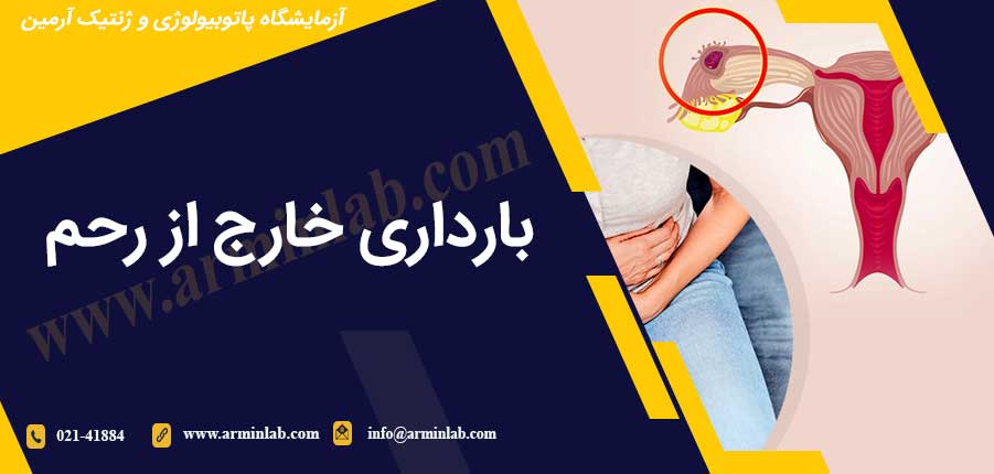 بارداری خارج از رحم