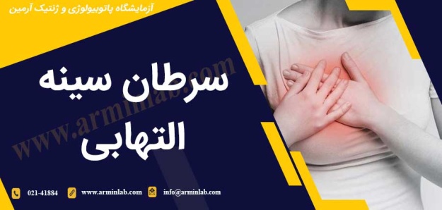 سرطان سینه التهابی