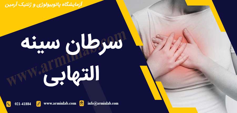 سرطان سینه التهابی