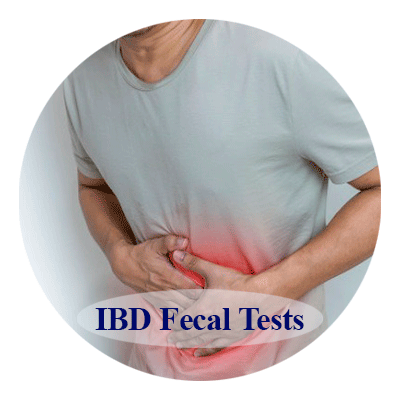 IBD Fecal Tests