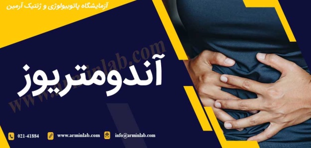 آندومتریوز