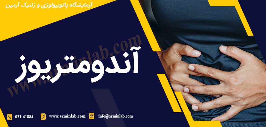 آندومتریوز