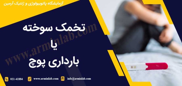 تخمک سوخته یا بارداری پوچ