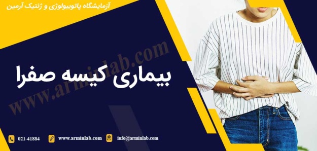 بیماری کیسه صفرا