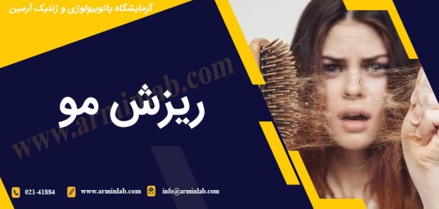 ریزش مو
