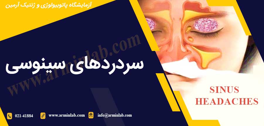 سردردهای سینوسی