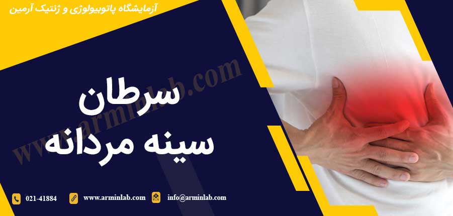 سرطان سینه مردانه