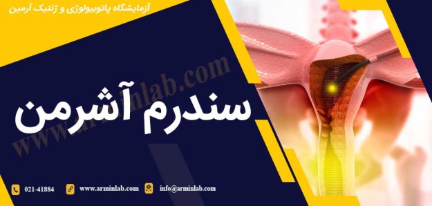 سندرم آشرمن