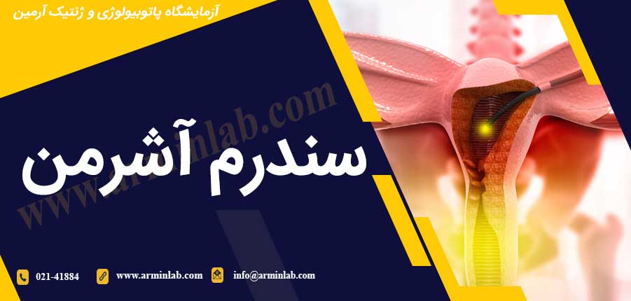 سندرم آشرمن