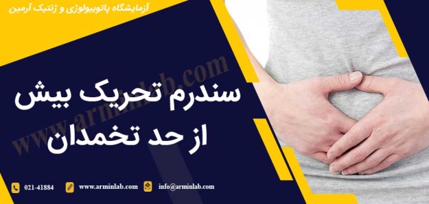 سندرم تحریک بیش از حد تخمدان