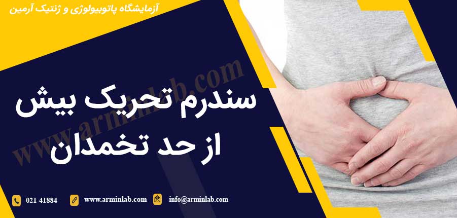 سندرم تحریک بیش از حد تخمدان