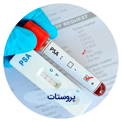 پروستات پروستات