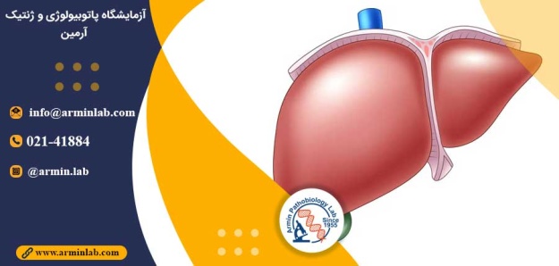 بیماری آندرسون (GSD IV)