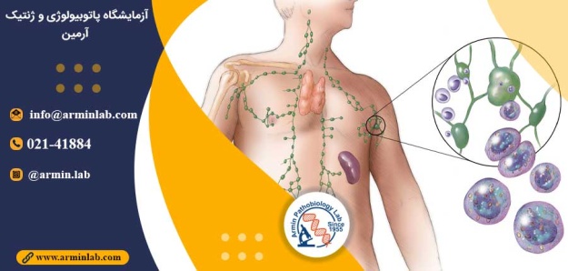 لنفوم سلول B