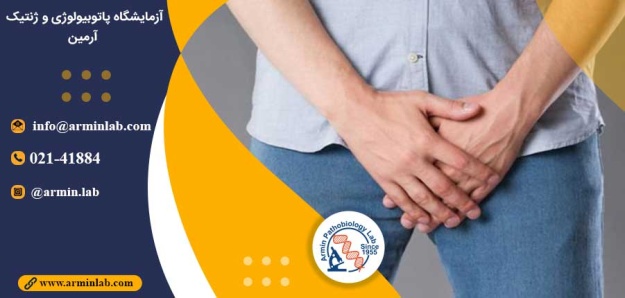 التهاب بیضه