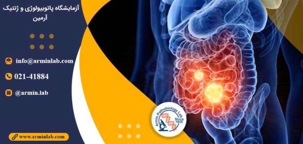 سرطان روده کوچک