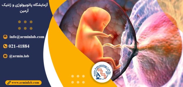 جفت کلسیفیه در بارداری