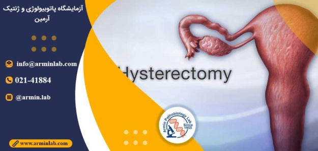 هیسترکتومی و دیابت نوع 2